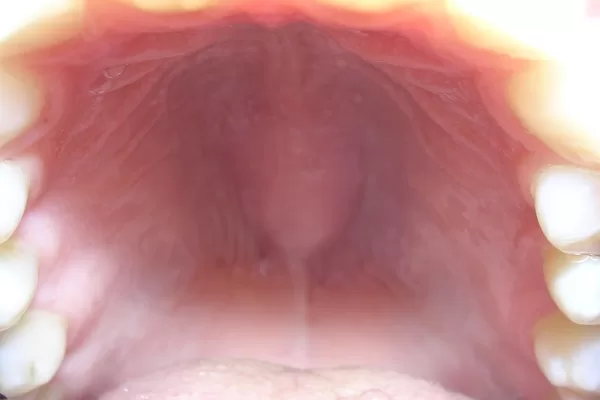 RUYADA DAMAK GÖRMEK