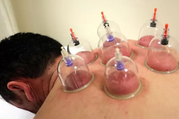 RUYADA HACAMAT (Kan aldırmak) GÖRMEK