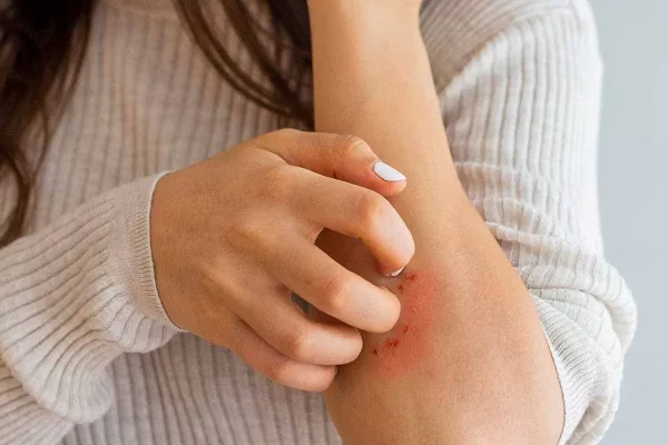 RUYADA   KAŞIMAK GÖRMEK