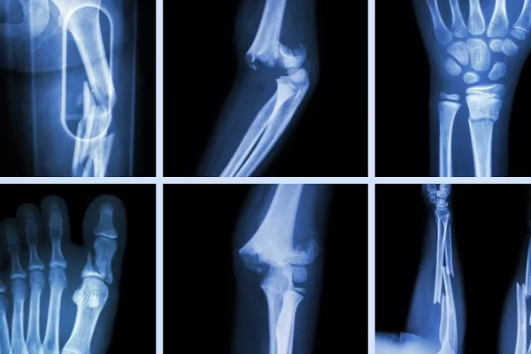 RUYADA   KIRIK GÖRMEK