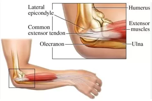 RUYADA  KOL VE DİRSEK GÖRMEK