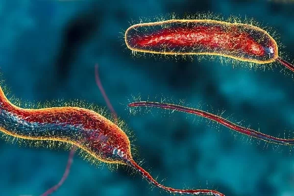 RUYADA   KOLERA GÖRMEK