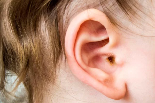 RUYADA    KULAK   KİRİ GÖRMEK