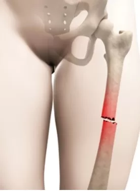 RUYADA   OYLUK GÖRMEK