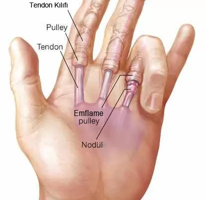 RUYADA  PARMAK GÖRMEK