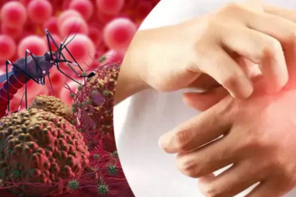 RUYADA  SITMA GÖRMEK