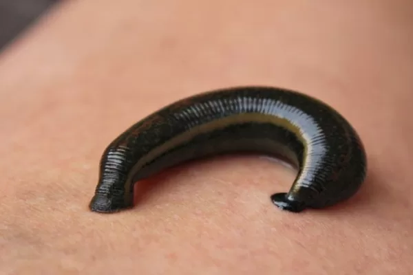 RUYADA  SÜLÜK GÖRMEK