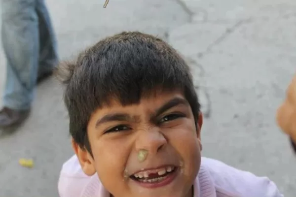 RUYADA   SÜMÜK GÖRMEK