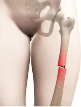 RUYADA  UYLUK GÖRMEK