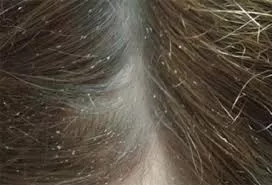 RUYADA  BİT GÖRMEK