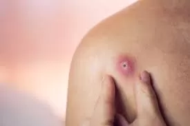 RUYADA ÇIBAN GÖRMEK