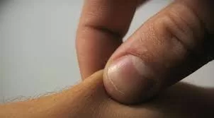 RUYADA ÇİMDİKLEMEK GÖRMEK