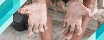 RUYADA CÜZZAM GÖRMEK